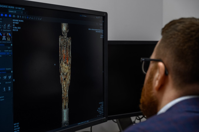 Zrodło: https://szpital.lublin.pl/